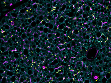 Scientists Discover Pathway That Activates Brown Fat